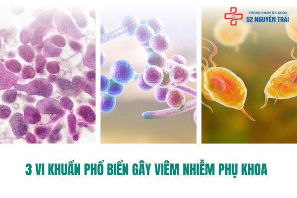 3 vi khuẩn phổ biến gây viêm nhiễm phụ khoa 