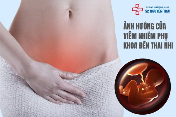 Ảnh hưởng của viêm nhiễm phụ khoa đến thai nhi