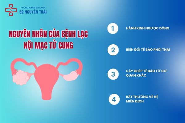 Nguyên nhân của bệnh lạc nội mạc tử cung