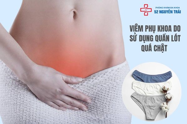 Dùng quần lót chật là nguyên nhân gây viêm nhiễm phụ khoa 