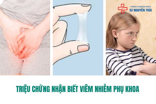 Triệu chứng của bệnh viêm phụ khoa