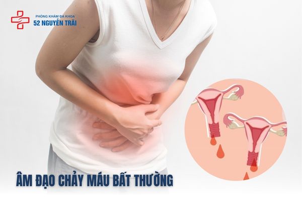 Chảy máu bất thường triệu chứng của bệnh ung thư cổ tử cung