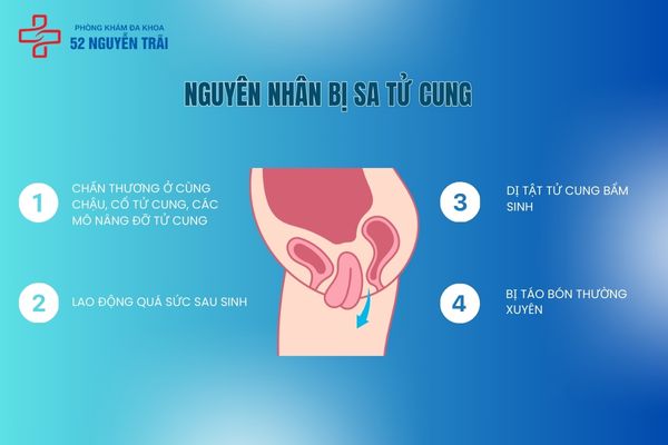 Nguyên nhân bị bệnh sa tử cung 