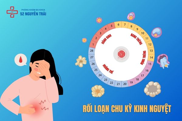 Rối loạn chu kỳ kinh nguyệt