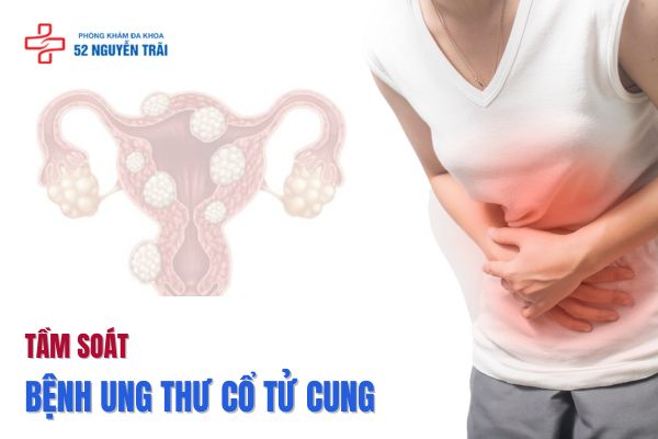 Tầm soát bệnh ung thư cổ tử cung 