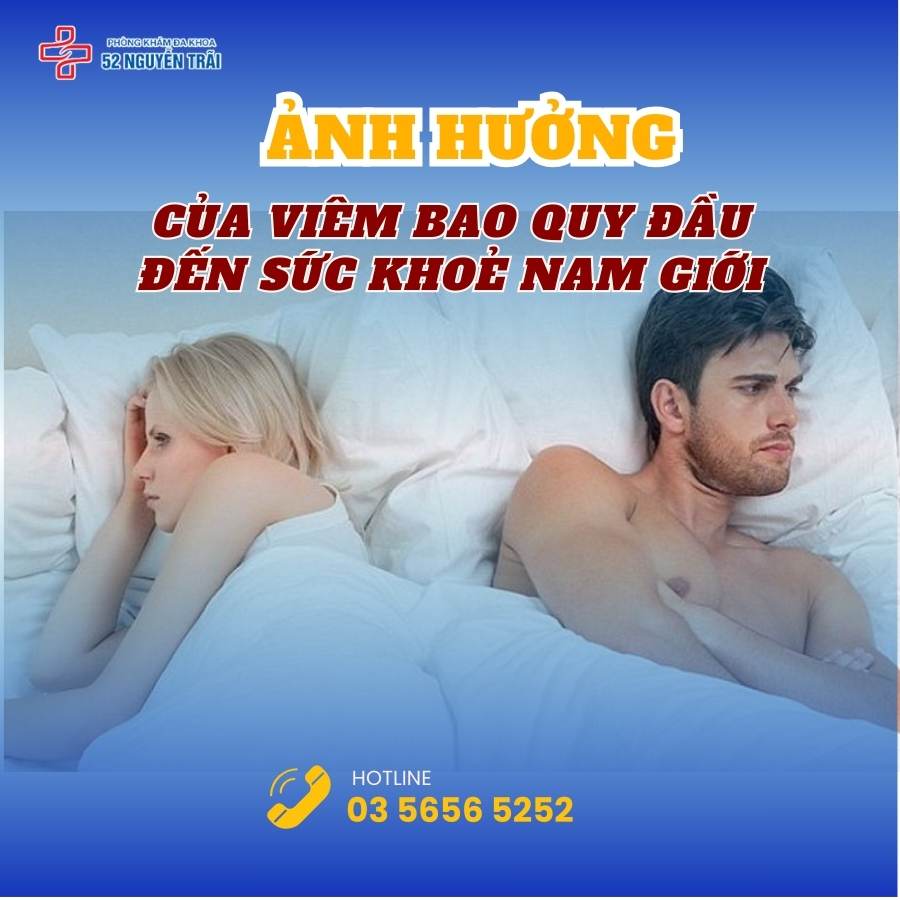 Ảnh hưởng của viêm bao quy đầu đến sức khoẻ nam giới