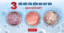 Dấu hiệu của viêm bao quy đầu