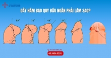 Dây hãm bao quy đầu ngắn