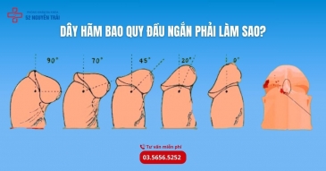 Dây hãm bao quy đầu ngắn