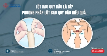 Lột bao quy đầu là gì?