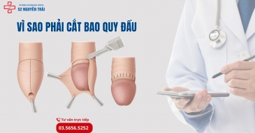 Vì sao phải cắt bao quy đầu?