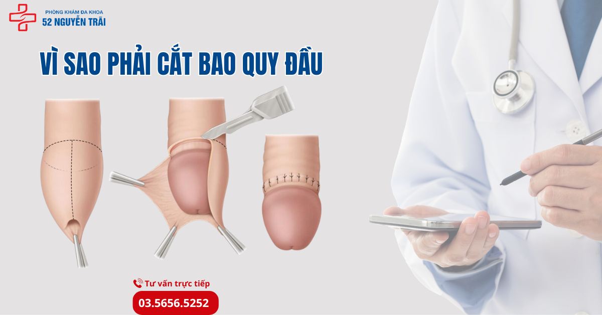 Vì sao phải cắt bao quy đầu?