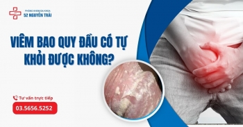 Viêm bao quy đầu có tự khỏi không?